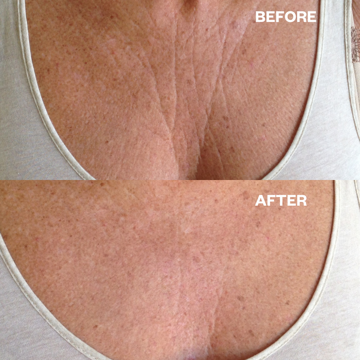 Chest Wrinkle Patch - 1 reusable silicone pad | Wrinkles Schminkles