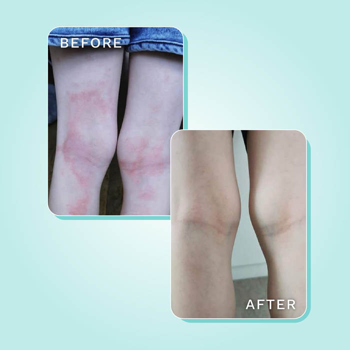 Dreamskin Eczema Children's Footless Leggings product image 4