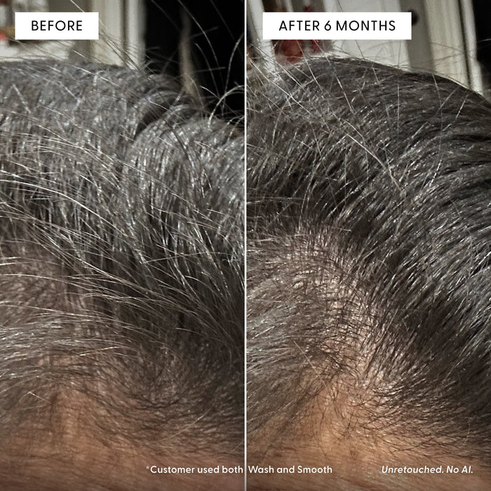 Close-up of a person’s scalp, split into Before and After 6 Months using Arey Wash Shampoo Refill. The After side displays visibly thicker, fuller hair, demonstrating improved hair health compared to the thinner hair shown on the Before side. Text indicates no retouching and no AI were used.