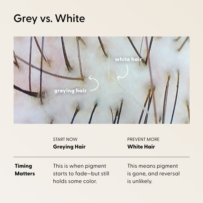 Close-up of scalp showing strands of greying hair and white hair, with text explaining that greying hair still contains some pigment, while white hair has lost its pigment and reversal is unlikely. Maintaining good hair health—with proper care and timely Arey Wash Shampoo Refill use—may help delay the appearance of greys, but restoring natural color once pigment is lost is uncommon.